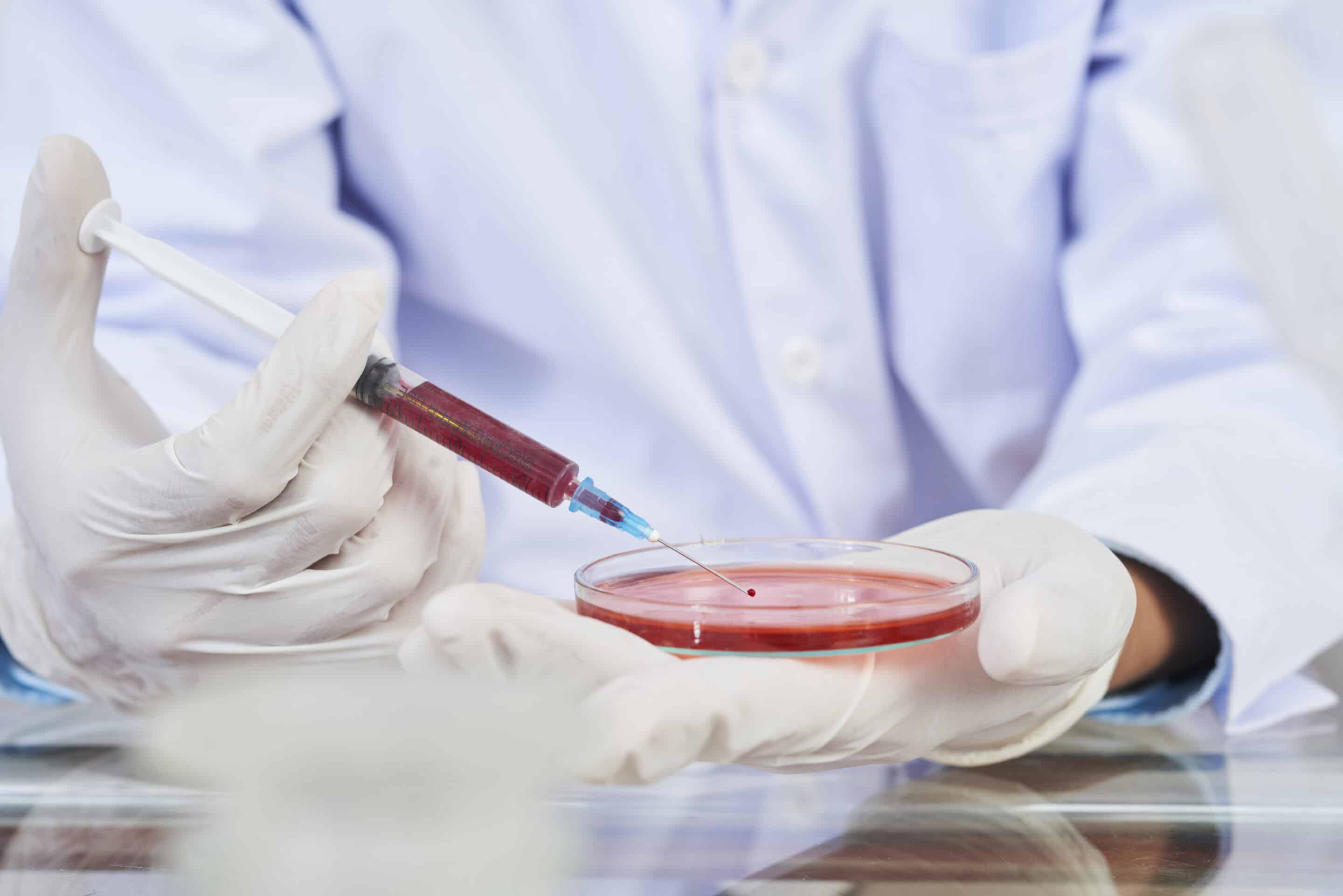 CAR-T Therapy for Myeloma: Could Immune Cells Change Cancer Treatment?